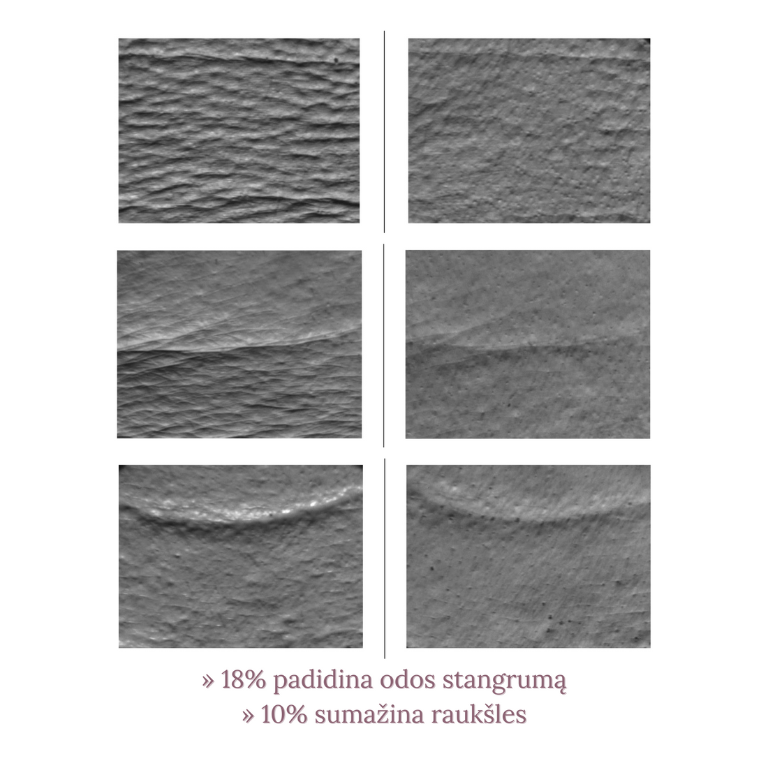 Fermentu serumo poveikis